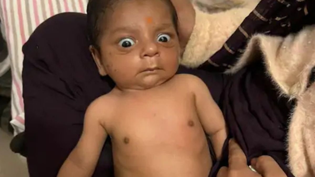 दिल में छेद लेकर जन्मी थी, 5 घंटे चले दो बड़े ऑपरेशन; जल्द लौटेगी जबलपुर