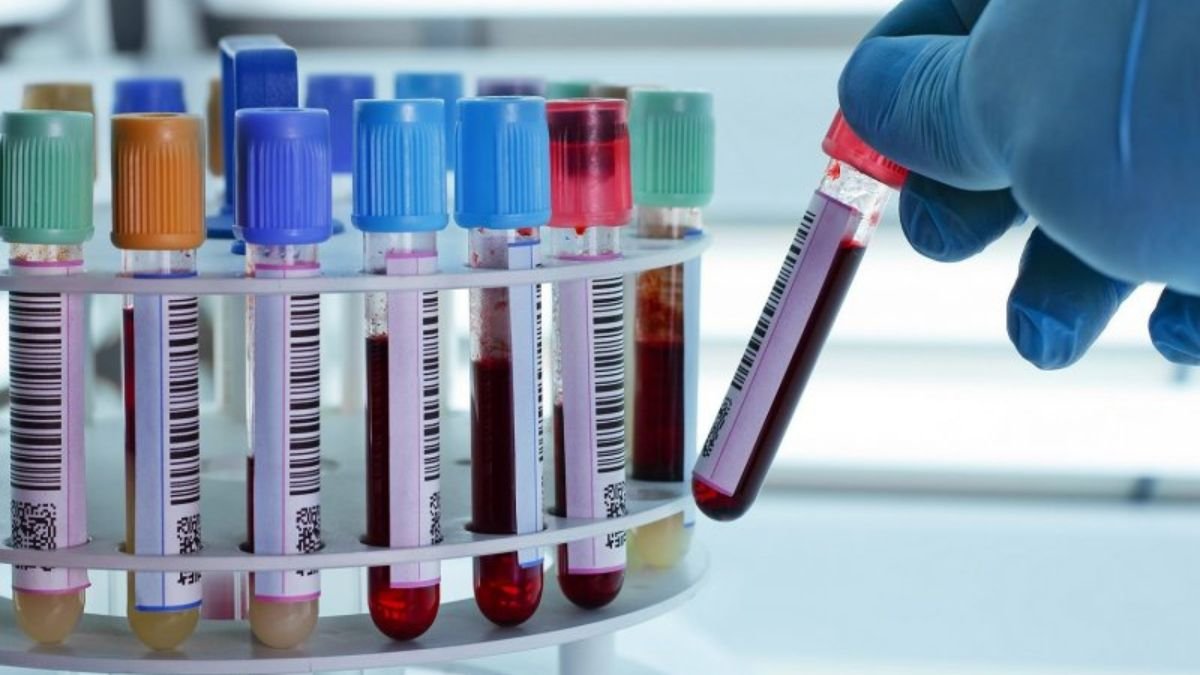 MP के सरकारी अस्पतालों की पैथोलॉजी जांचों में बड़े पैमाने पर गड़बड़ी स्वीकार, सवालों के घेरे में 943 करोड़ का हिसाब