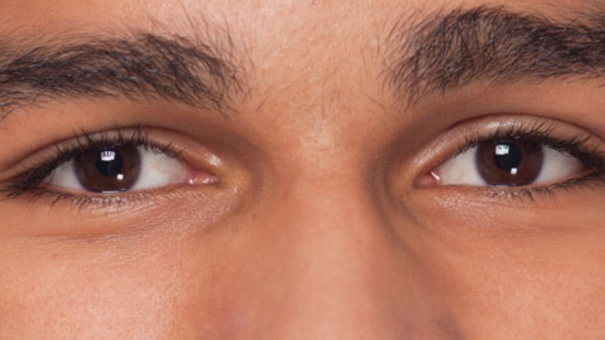 आंखों के आसपास ड्राईनेस से हैं परेशान, तो छोड़ें महंगी क्रीम; अपनाएं ये घरेलू नुस्खे